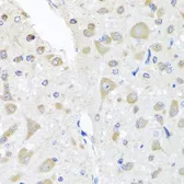 Anti-PCID1 antibody used in IHC (Paraffin sections) (IHC-P). GTX64817