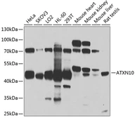 Anti-ATXN10 antibody used in Western Blot (WB). GTX64818