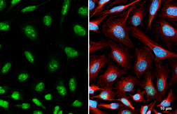 Anti-c-Myc antibody [HL6095] used in Immunocytochemistry/ Immunofluorescence (ICC/IF). GTX648180