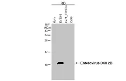 Anti-Enterovirus D68 2B antibody [HL6099] used in Western Blot (WB). GTX648184