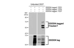 Anti-Frizzled 7 antibody [HL6104] used in Western Blot (WB). GTX648189
