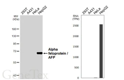 Anti-Alpha fetoprotein / AFP antibody [HL6119] used in Western Blot (WB). GTX648204