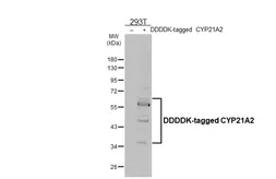 Anti-CYP21A2 antibody [HL6124] used in Western Blot (WB). GTX648209
