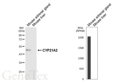 Anti-CYP21A2 antibody [HL6128] used in Western Blot (WB). GTX648213