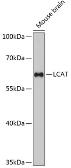 Anti-LCAT antibody used in Western Blot (WB). GTX64822