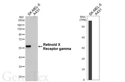 Anti-Retinoid X Receptor gamma antibody [HL6140] used in Western Blot (WB). GTX648227