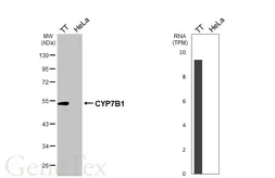 Anti-CYP7B1 antibody [HL6162] used in Western Blot (WB). GTX648249