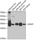 Anti-GNMT antibody used in Western Blot (WB). GTX64826