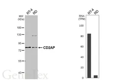 Anti-CD2AP antibody [HL6174] used in Western Blot (WB). GTX648261
