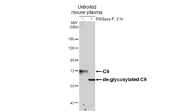 Anti-C9 antibody [HL6178] used in Western Blot (WB). GTX648270