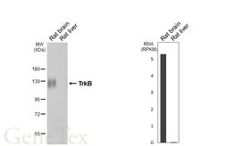 Anti-TrkB antibody [HL6182] used in Western Blot (WB). GTX648274