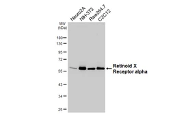 Anti-Retinoid X Receptor alpha antibody [HL6191] used in Western Blot (WB). GTX648283