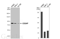 Anti-CD2AP antibody [HL6216] used in Western Blot (WB). GTX648308