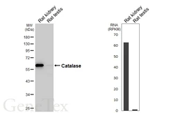 Anti-Catalase antibody [HL6227] used in Western Blot (WB). GTX648319