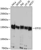 Anti-TFII-I antibody used in Western Blot (WB). GTX64832