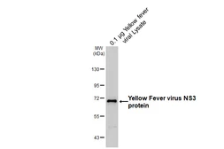 Anti-Yellow Fever virus NS3 protein antibody [HL6232] used in Western Blot (WB). GTX648324