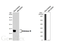 Anti-Aldolase B antibody [HL6236] used in Western Blot (WB). GTX648328