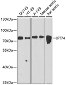 Anti-CMG1 antibody used in Western Blot (WB). GTX64834