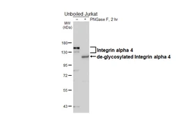 Anti-Integrin alpha 4 antibody [HL6249] used in Western Blot (WB). GTX648341