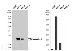 Anti-Caveolin 1 antibody [HL6264] used in Western Blot (WB). GTX648356