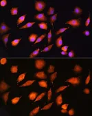 Anti-EXT2 antibody used in Immunocytochemistry/ Immunofluorescence (ICC/IF). GTX64836