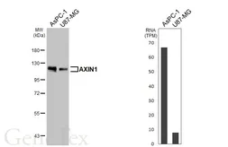 Anti-AXIN1 antibody [HL6295] used in Western Blot (WB). GTX648397