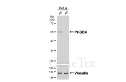 Anti-PHGDH antibody [HL6297] used in Western Blot (WB). GTX648399