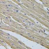 Anti-EIF4A2 antibody used in IHC (Paraffin sections) (IHC-P). GTX64840