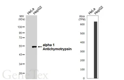 Anti-alpha 1 Antichymotrypsin antibody [HL6303] used in Western Blot (WB). GTX648405