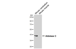 Anti-Aldolase C antibody [HL6306] used in Western Blot (WB). GTX648408