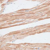 Anti-GRK5 antibody used in IHC (Paraffin sections) (IHC-P). GTX64841