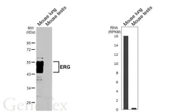 Anti-ERG antibody [HL6309] used in Western Blot (WB). GTX648411