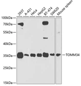 Anti-TOMM34 antibody used in Western Blot (WB). GTX64843