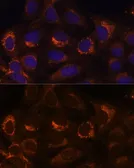 Anti-HIBADH antibody used in Immunocytochemistry/ Immunofluorescence (ICC/IF). GTX64844