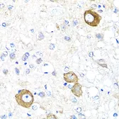 Anti-NRG4 antibody used in IHC (Paraffin sections) (IHC-P). GTX64845