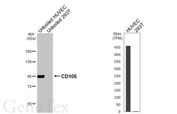 Anti-CD105 antibody [HL6345] used in Western Blot (WB). GTX648455