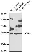 Anti-KChIP2 antibody used in Western Blot (WB). GTX64846