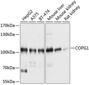 Anti-COPG antibody used in Western Blot (WB). GTX64849