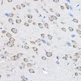 Anti-PTPN23 antibody used in IHC (Paraffin sections) (IHC-P). GTX64851