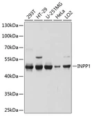 Anti-INPP1 antibody used in Western Blot (WB). GTX64856