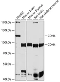 Anti-R-Cadherin antibody used in Western Blot (WB). GTX64857