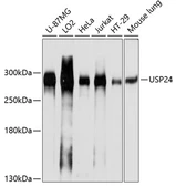 Anti-USP24 antibody used in Western Blot (WB). GTX64858