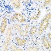 Anti-SRPX antibody used in IHC (Paraffin sections) (IHC-P). GTX64860