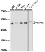 Anti-RBM17 antibody used in Western Blot (WB). GTX64861