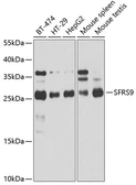 Anti-SFRS9 antibody used in Western Blot (WB). GTX64863
