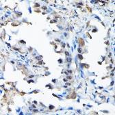 Anti-RBBP9 antibody used in IHC (Paraffin sections) (IHC-P). GTX64865