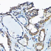 Anti-RBBP9 antibody used in IHC (Paraffin sections) (IHC-P). GTX64865