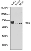 Anti-Rhotekin antibody used in Western Blot (WB). GTX64868