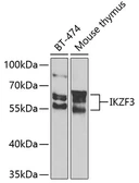 Anti-IKZF3 antibody used in Western Blot (WB). GTX64869