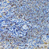 Anti-RPL23A antibody used in IHC (Paraffin sections) (IHC-P). GTX64876